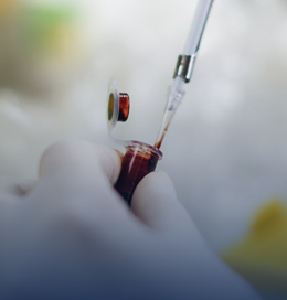 Liquid biopsy - Illustration
