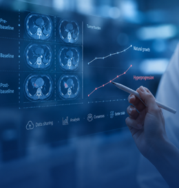 Evaluation of cancer hyperprogression after immunotherapy- Illustration