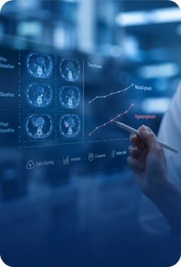 Evaluation of cancer hyperprogression after immunotherapy- Illustration